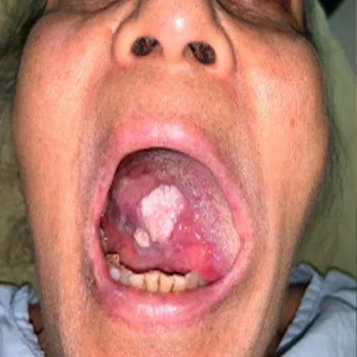 Patient before oral surgery treatment