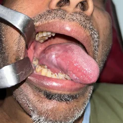Patient before oral surgery treatment