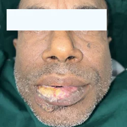 Patient before oral surgery treatment