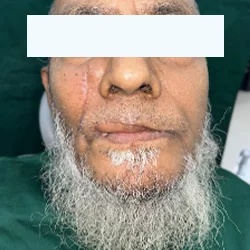 Patient after oral surgery treatment