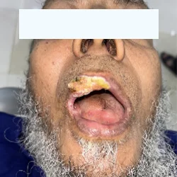 Patient before oral surgery treatment